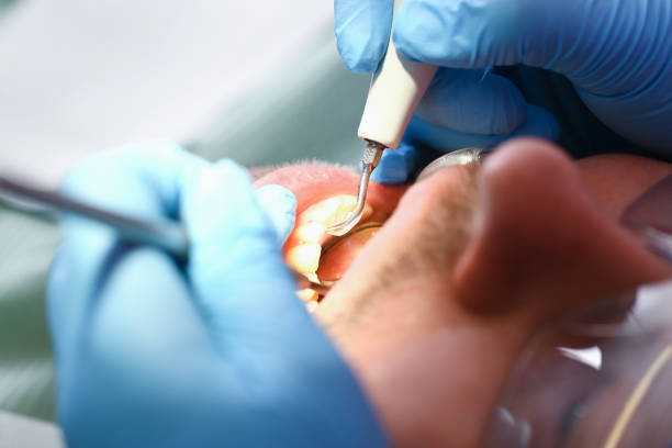 Best Emergency Root Canal Therapy in West Wood, UT